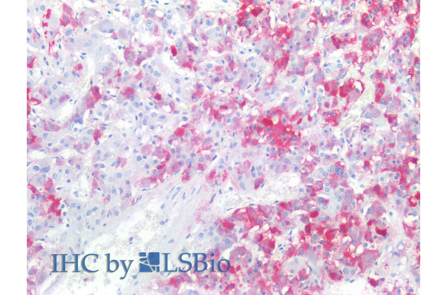 IHC - Anti-CD57 Antibody [TB01] (A86858)