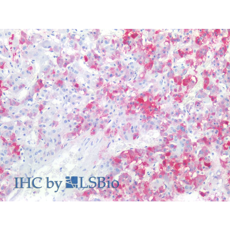 IHC - Anti-CD57 Antibody [TB01] (A86858)