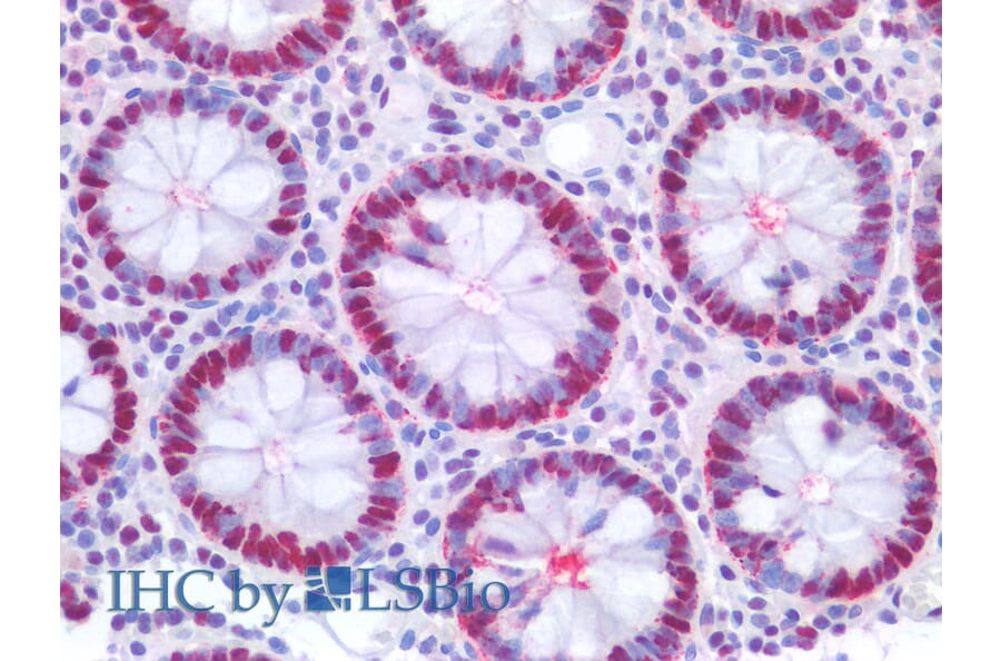 IHC - Anti-PCNA Antibody [PC10] (A86878)