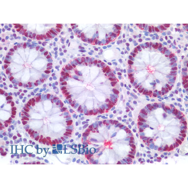 IHC - Anti-PCNA Antibody [PC10] (A86878)