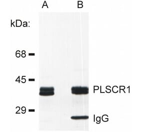 IP - Anti-Scramblase 1 Antibody [13A6 [TEC-23]] (A86880)