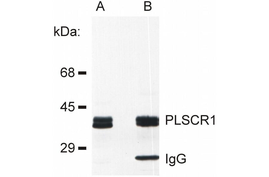 IP - Anti-Scramblase 1 Antibody [13A6 [TEC-23]] (A86880)