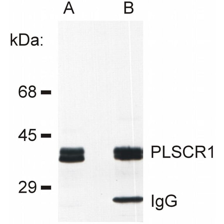 IP - Anti-Scramblase 1 Antibody [13A6 [TEC-23]] (A86880)