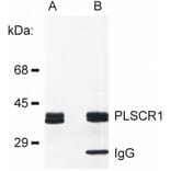 IP - Anti-Scramblase 1 Antibody [13A6 [TEC-23]] (A86880)