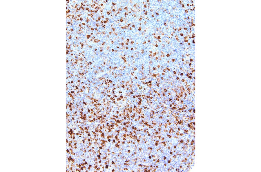 Immunohistochemistry - Anti-Annexin A1/ANXA1 Antibody [IHC512] (A86886) - Antibodies.com