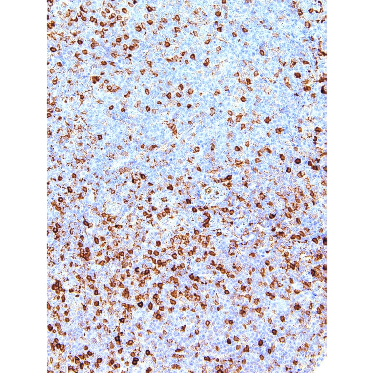 Immunohistochemistry - Anti-Annexin A1/ANXA1 Antibody [IHC512] (A86886) - Antibodies.com