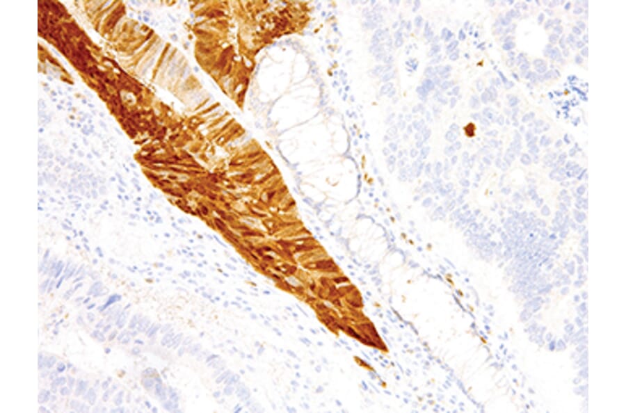Immunohistochemistry - Anti-Arginase 1 Antibody (IHC400) - Antibodies.com