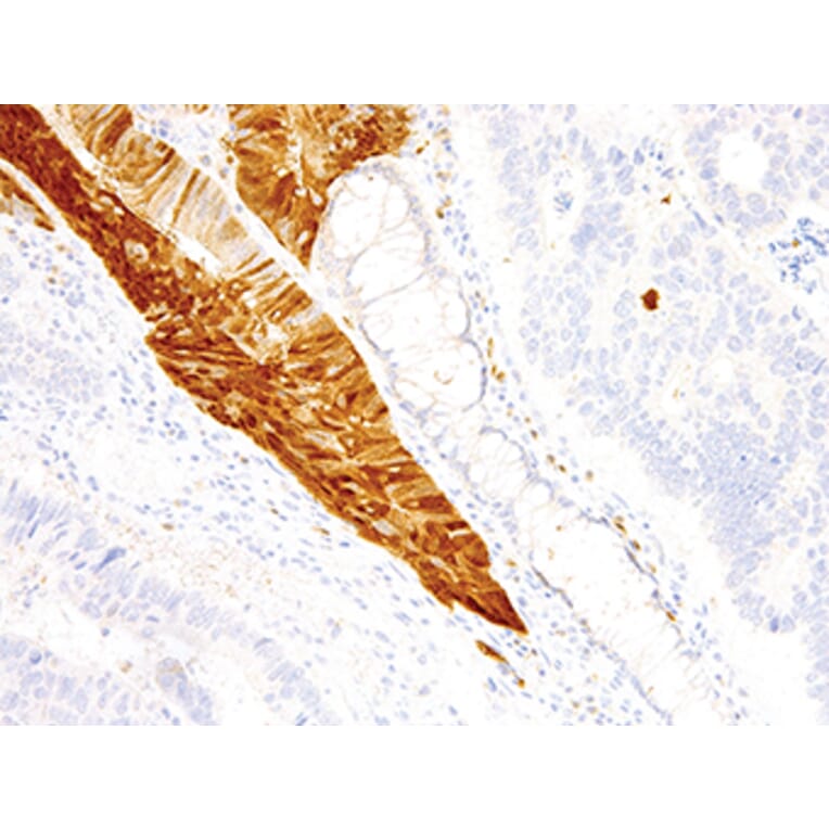 Immunohistochemistry - Anti-Arginase 1 Antibody (IHC400) - Antibodies.com