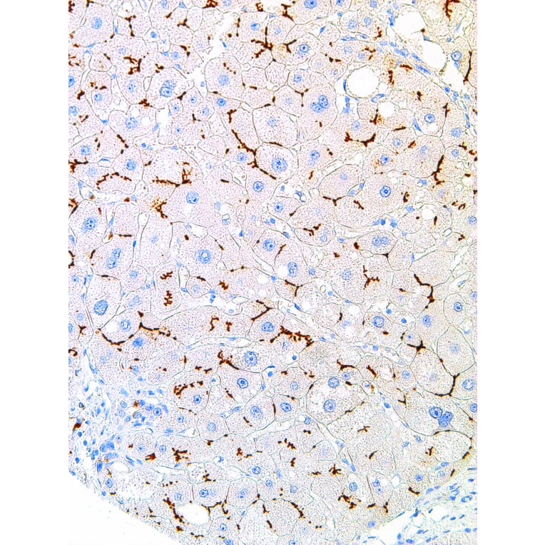 Immunohistochemistry - Anti-ABCB11/BSEP Antibody [IHC518] (A86888) - Antibodies.com