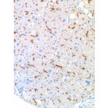 Immunohistochemistry - Anti-ABCB11/BSEP Antibody [IHC518] (A86888) - Antibodies.com