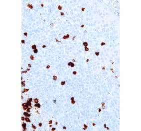 Immunohistochemistry - Anti-B3GAT1 Antibody [IHC539] (A86890) - Antibodies.com