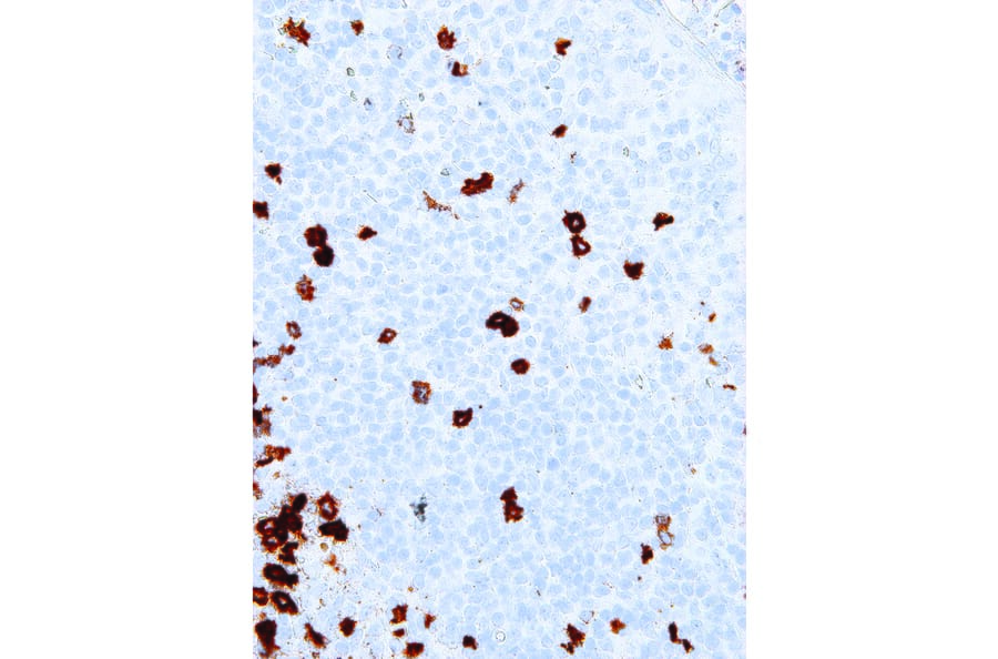Immunohistochemistry - Anti-B3GAT1 Antibody [IHC539] (A86890) - Antibodies.com