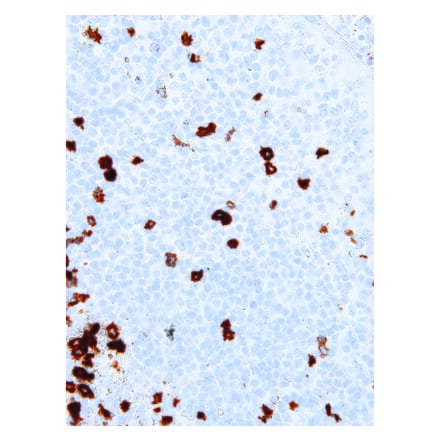 Immunohistochemistry - Anti-B3GAT1 Antibody [IHC539] (A86890) - Antibodies.com