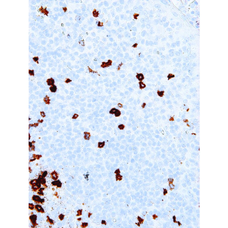 Immunohistochemistry - Anti-B3GAT1 Antibody [IHC539] (A86890) - Antibodies.com