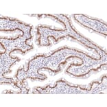 Immunohistochemistry - Anti-CDX 2 Antibody (IHC402) - Antibodies.com