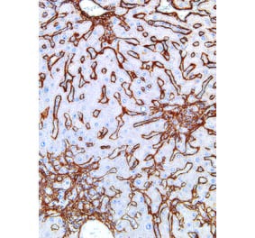 Immunohistochemistry - Anti-Collagen IV Antibody [IHC549] (A86892) - Antibodies.com