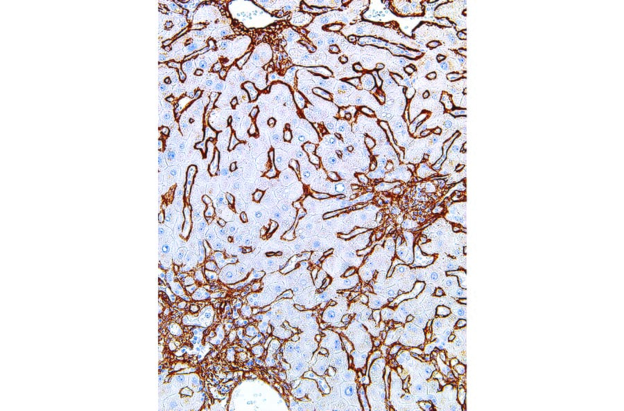 Immunohistochemistry - Anti-Collagen IV Antibody [IHC549] (A86892) - Antibodies.com