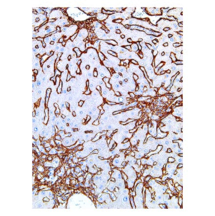 Immunohistochemistry - Anti-Collagen IV Antibody [IHC549] (A86892) - Antibodies.com