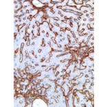 Immunohistochemistry - Anti-Collagen IV Antibody [IHC549] (A86892) - Antibodies.com