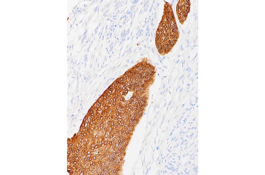 Immunohistochemistry - Anti-Cytokeratin 14 Antibody [IHC555] (A86893) - Antibodies.com