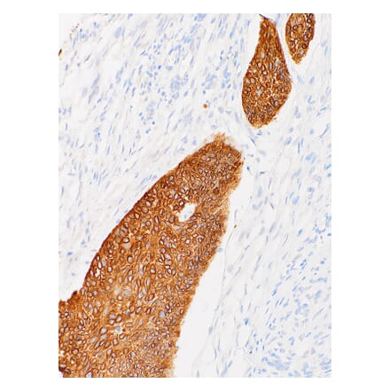Immunohistochemistry - Anti-Cytokeratin 14 Antibody [IHC555] (A86893) - Antibodies.com