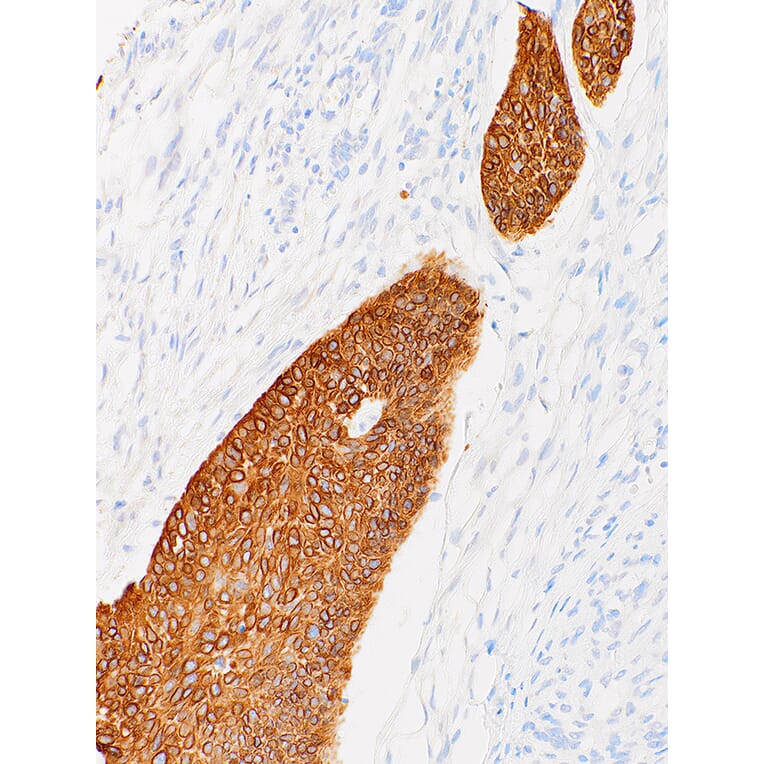 Immunohistochemistry - Anti-Cytokeratin 14 Antibody [IHC555] (A86893) - Antibodies.com