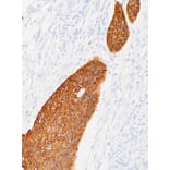 Immunohistochemistry - Anti-Cytokeratin 14 Antibody [IHC555] (A86893) - Antibodies.com