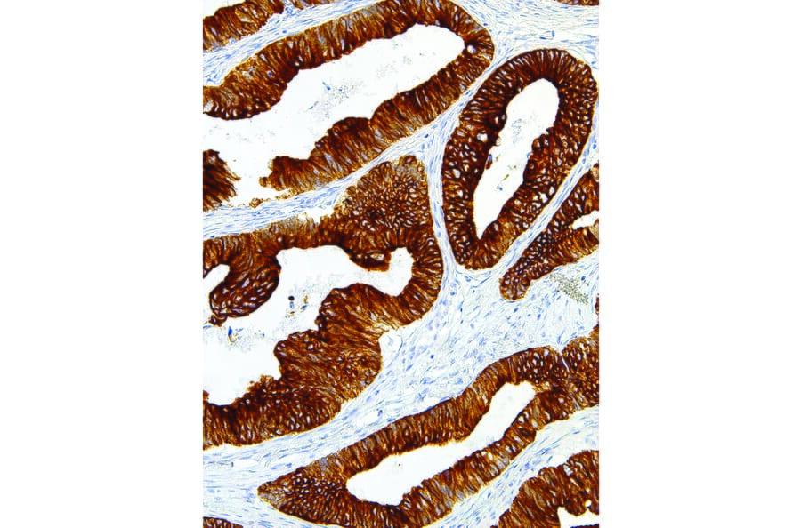 Immunohistochemistry - Anti-Cytokeratin 18 Antibody [IHC018] (A86894) - Antibodies.com