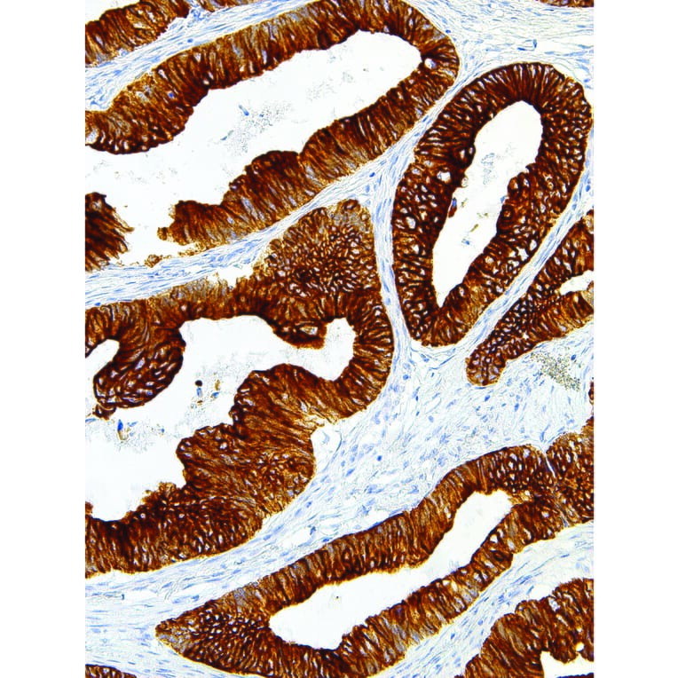 Immunohistochemistry - Anti-Cytokeratin 18 Antibody [IHC018] (A86894) - Antibodies.com