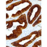 Immunohistochemistry - Anti-Cytokeratin 18 Antibody [IHC018] (A86894) - Antibodies.com