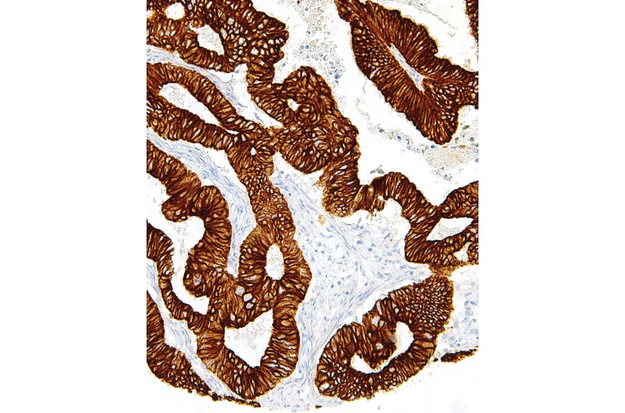 Immunohistochemistry - Anti-Cytokeratin 19 Antibody [IHC019] (A86895) - Antibodies.com