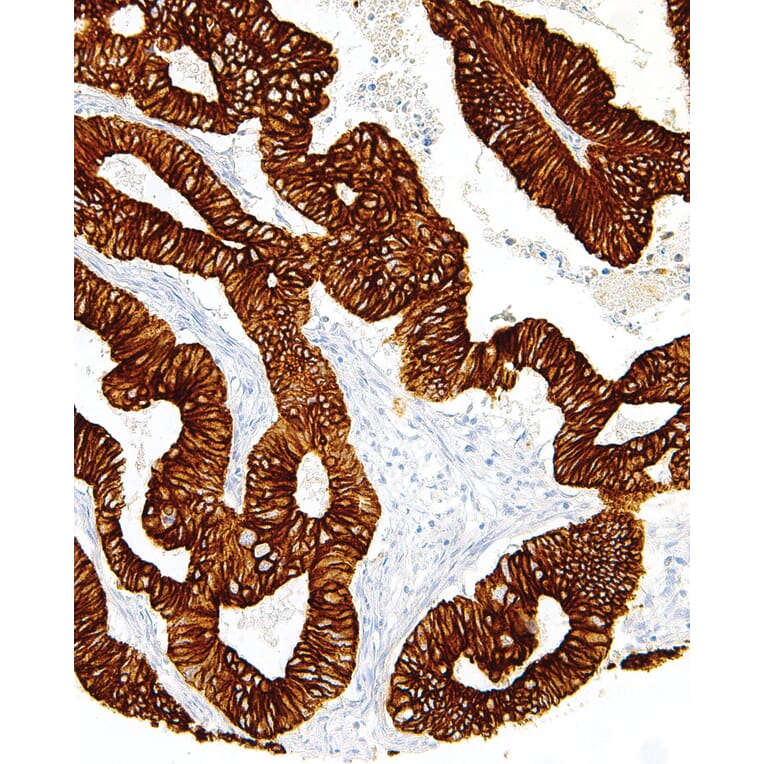 Immunohistochemistry - Anti-Cytokeratin 19 Antibody [IHC019] (A86895) - Antibodies.com