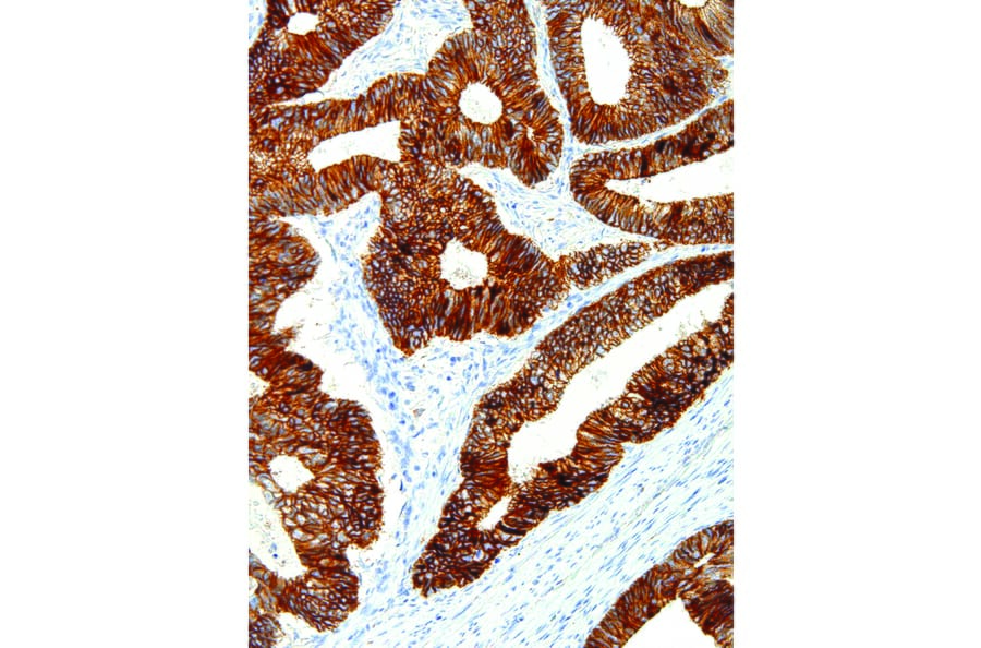 Immunohistochemistry - Anti-E Cadherin Antibody [IHC564] (A86896) - Antibodies.com