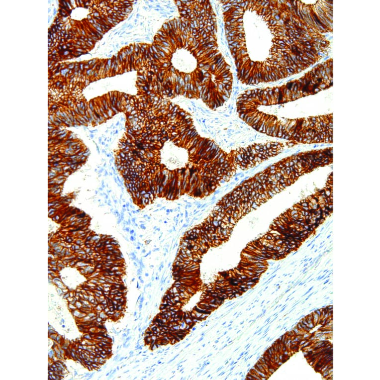 Immunohistochemistry - Anti-E Cadherin Antibody [IHC564] (A86896) - Antibodies.com