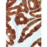 Immunohistochemistry - Anti-E Cadherin Antibody [IHC564] (A86896) - Antibodies.com