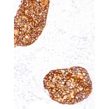 Immunohistochemistry - Anti-ErbB2/HER2 Antibody [IHC002] (A86897) - Antibodies.com