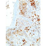 Immunohistochemistry - Anti-Melanoma Associated Antigen Antibody [IHC062] (A86898) - Antibodies.com