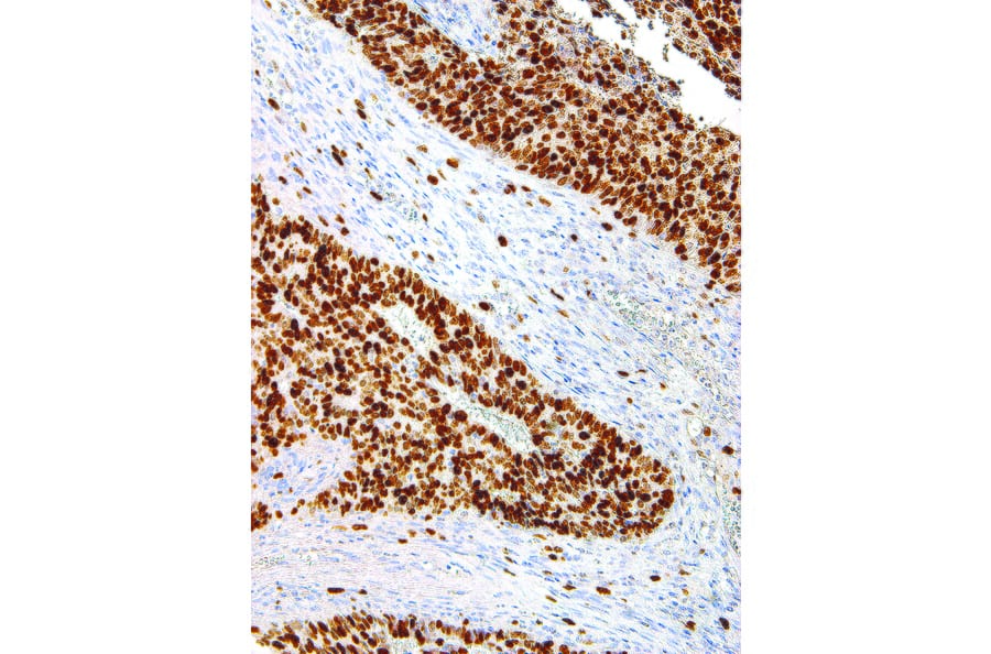 Immunohistochemistry - Anti-Ki67 Antibody [IHC067] (A86899) - Antibodies.com