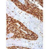 Immunohistochemistry - Anti-Ki67 Antibody [IHC067] (A86899) - Antibodies.com