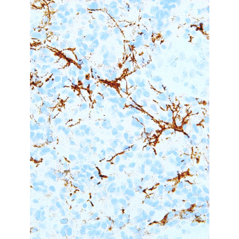 Immunohistochemistry - Anti-p75 NGF Receptor Antibody [IHC637] (A86900) - Antibodies.com