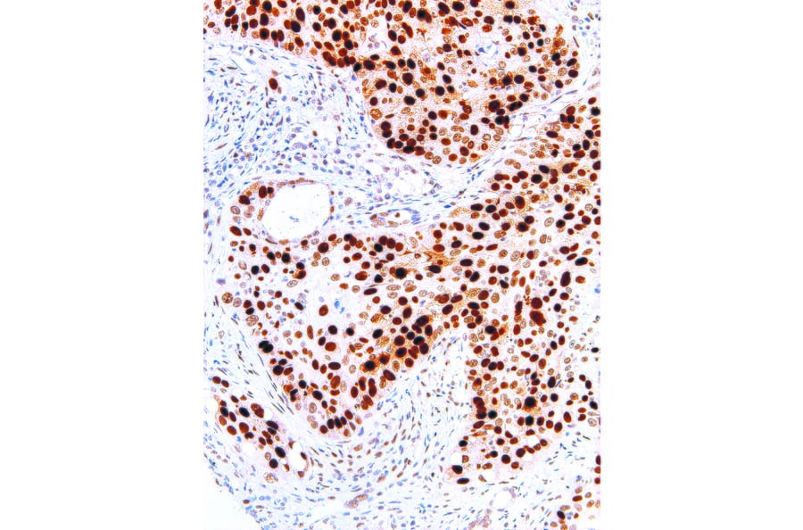 Immunohistochemistry - Anti-p53 Antibody [IHC053] (A86901) - Antibodies.com