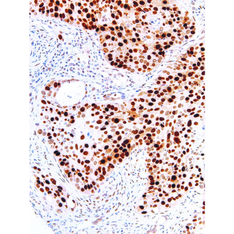 Immunohistochemistry - Anti-p53 Antibody [IHC053] (A86901) - Antibodies.com