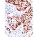 Immunohistochemistry - Anti-p53 Antibody [IHC053] (A86901) - Antibodies.com