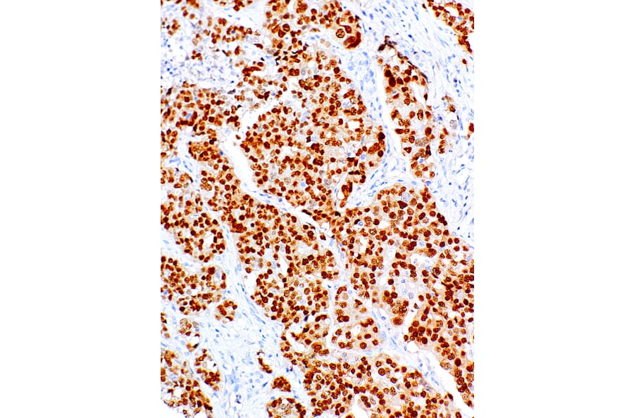 Immunohistochemistry - Anti-PAX8 Antibody [IHC008] (A86902) - Antibodies.com