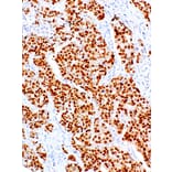 Immunohistochemistry - Anti-PAX8 Antibody [IHC008] (A86902) - Antibodies.com