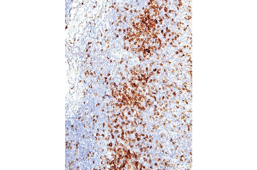 Immunohistochemistry - Anti-PD1 Antibody [IHC001] (A86903) - Antibodies.com