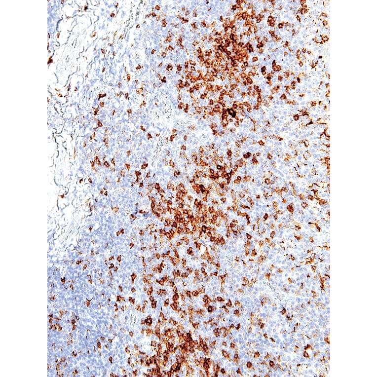 Immunohistochemistry - Anti-PD1 Antibody [IHC001] (A86903) - Antibodies.com