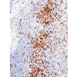 Immunohistochemistry - Anti-PD1 Antibody [IHC001] (A86903) - Antibodies.com