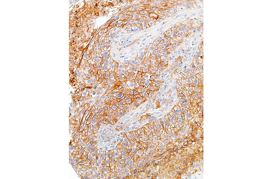 Immunohistochemistry - Anti-PD-L1 Antibody [IHC411] (A86904) - Antibodies.com