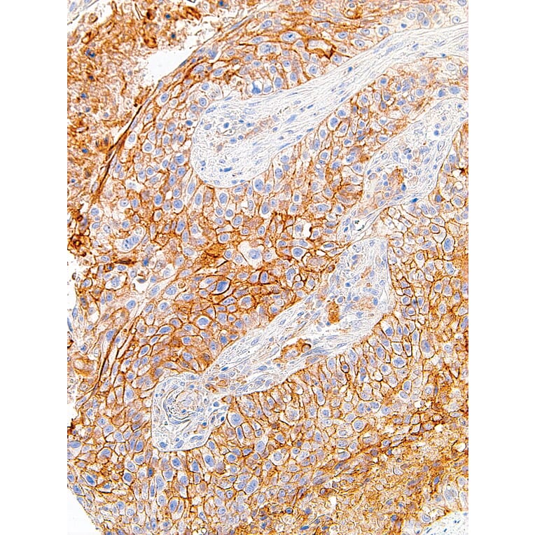 Immunohistochemistry - Anti-PD-L1 Antibody [IHC411] (A86904) - Antibodies.com